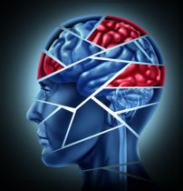 Mózgowe przyczyny zaburzeń mowy